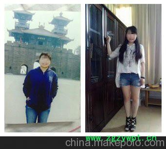 重庆健康减肥  重庆针灸减肥  重庆埋线减肥  重庆和苗减肥