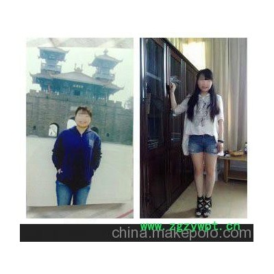 重庆健康减肥  重庆针灸减肥  重庆埋线减肥  重庆和苗减肥