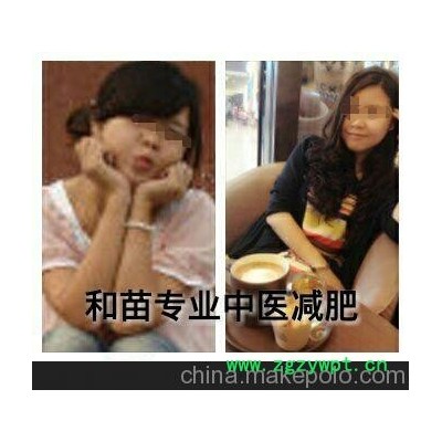 江北和苗提供最优的重庆中医针灸埋线减肥