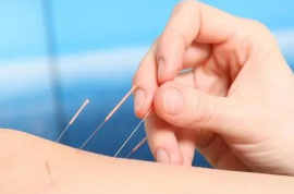 针刺能有效提高戒烟成功率